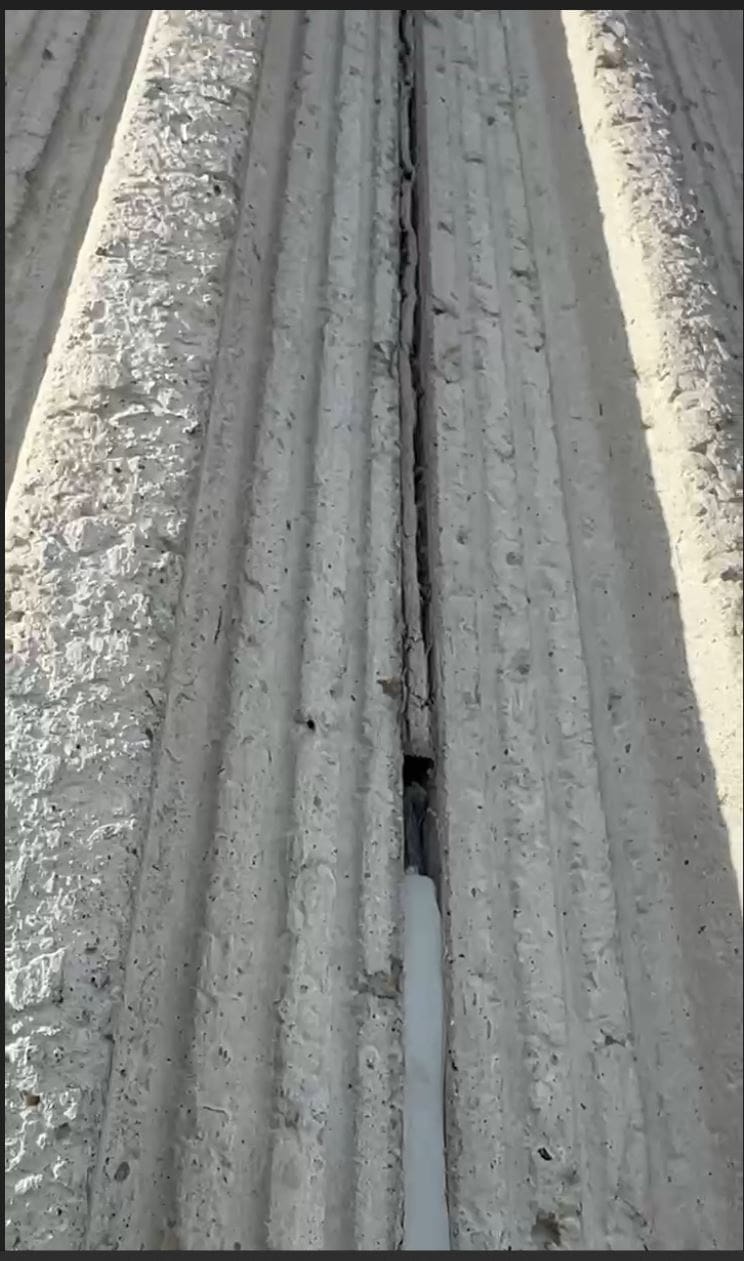 before and after section